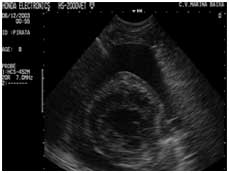 Ecografía General y Ecocardiografía