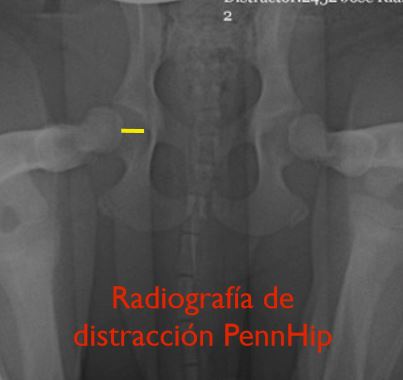 Radiografías PennHip