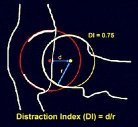 Radiografías PennHip