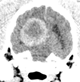 Tumor Cerebral en Perros y Gatos