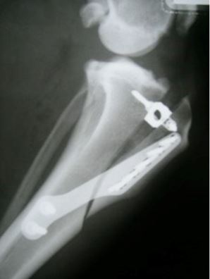 ligamento cruzado craneal