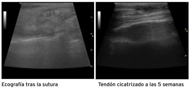 tendon de aquiles en un perro